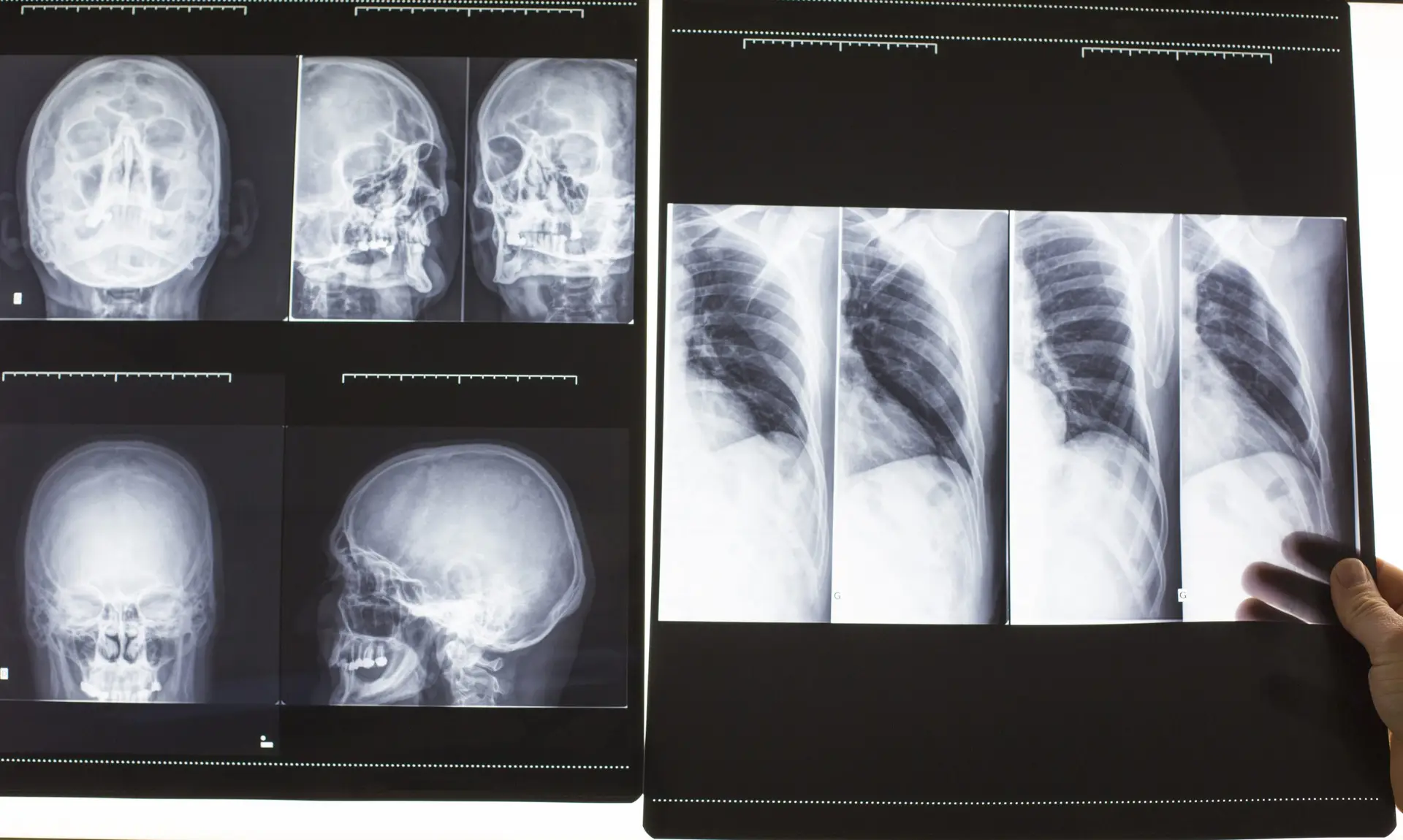 Advanced diagnostic imaging including X-ray ultrasound and EKG services at Sayf Primary Care Oakbrook Terrace Illinois